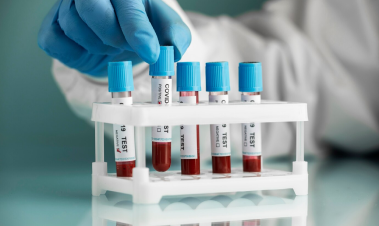 advantages of availing home blood sample collection services